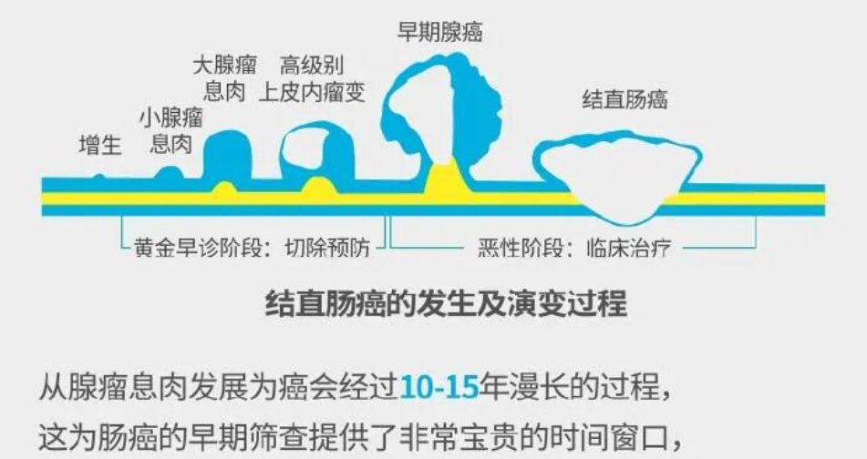 fh染色检测是什么这种癌症有10年癌前窗口期，多数人却拖到中晚期，一招提前揪出来_https://www.jmylbn.com_新闻资讯_第2张
