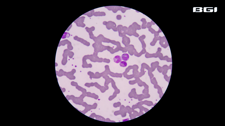 0912Sepsis.png