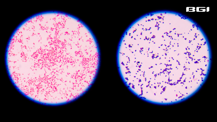 1106ImageGram-negativeBacteria.png