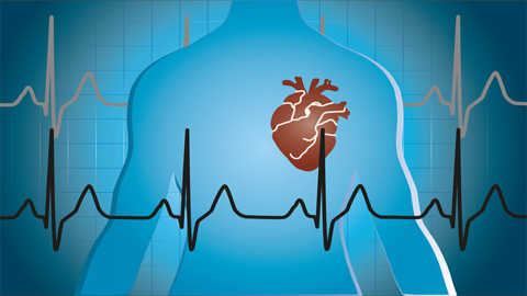 CardioGen Upgrade Helps Clinicians Accurately Diagnose Monogenic Cardiovascular Diseases