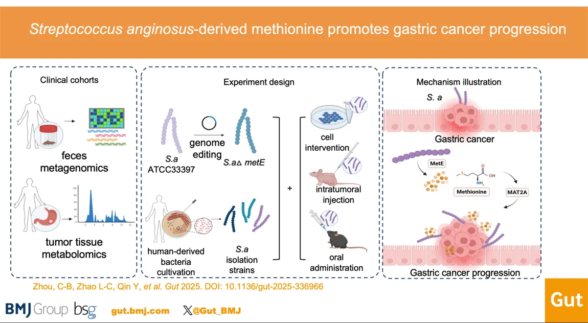 New Evidence Reveals Streptococcus Anginosus Promotes Gastric