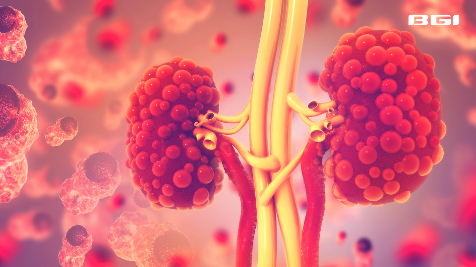 Early-Onset Kidney Disease Up Nearly 30% in Three Decades | World Kidney Day