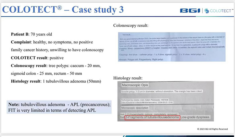 colotectpatientpolandsmaller.jpg